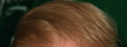 Trumpafella Skank (The Donald on the half shell)